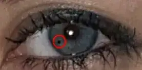 eye