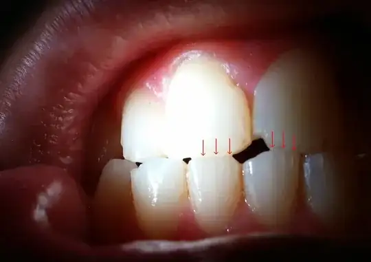 Teeth 1