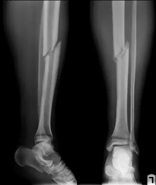 Fracture as at 23 October 2015