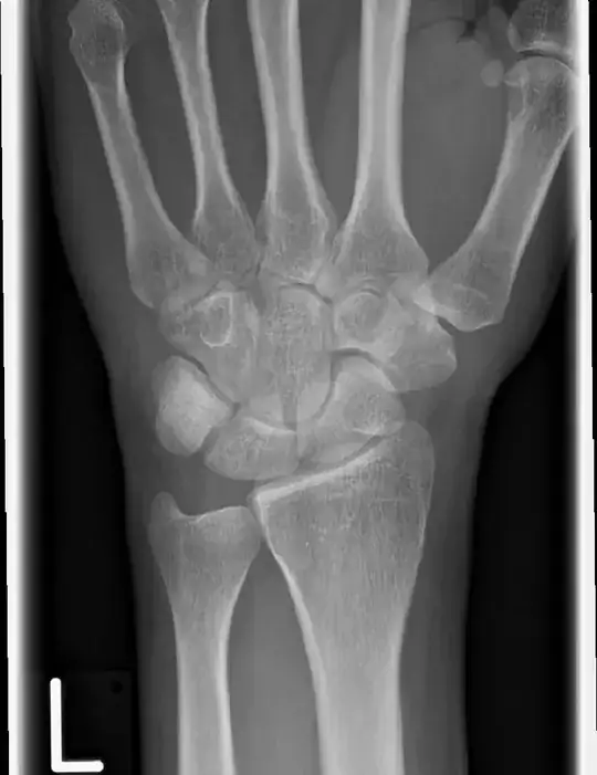 left hand