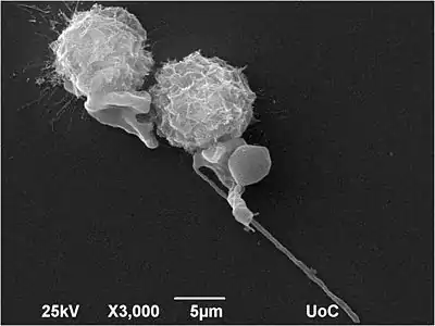 Anaplastic thyroid carcinoma cells