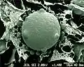 Chytrid (flagellated fungus)
