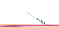 Step 4