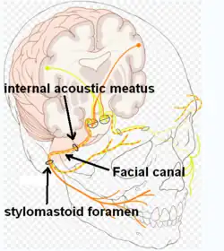Facial canal