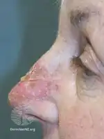 Day 6