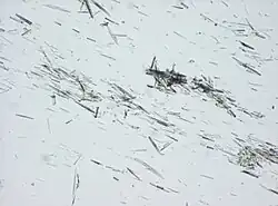 Light microscopy of a tophus, showing needle-shaped crystals.