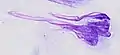 Smearing of cells across a glass plate may cause smearing artifacts, such as the nuclear smearing of this monocyte, shown as tail-like extension of nuclear material.
